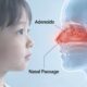 Adenoidid: Complete, Simple Guide to Swollen Adenoids